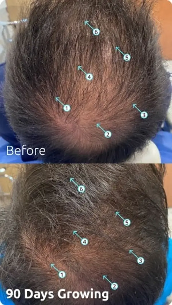 wougy before after1.webp