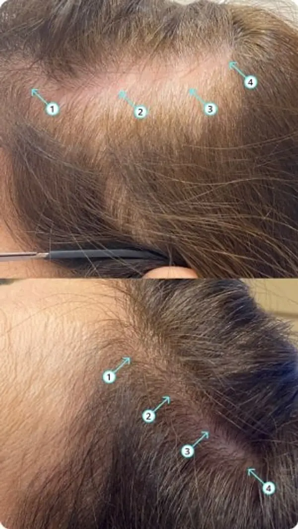 wougy before after2.webp