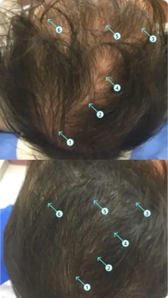 wougy before after3.webp