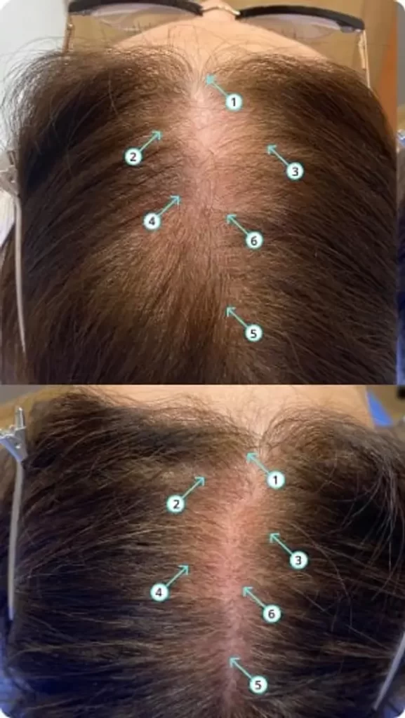 wougy before after4.webp